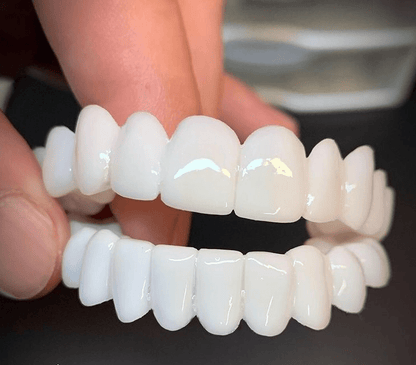 Snap On Veneers | Removable Teeth Veneers | Instant Smile Teeth Cover | SmileFlex