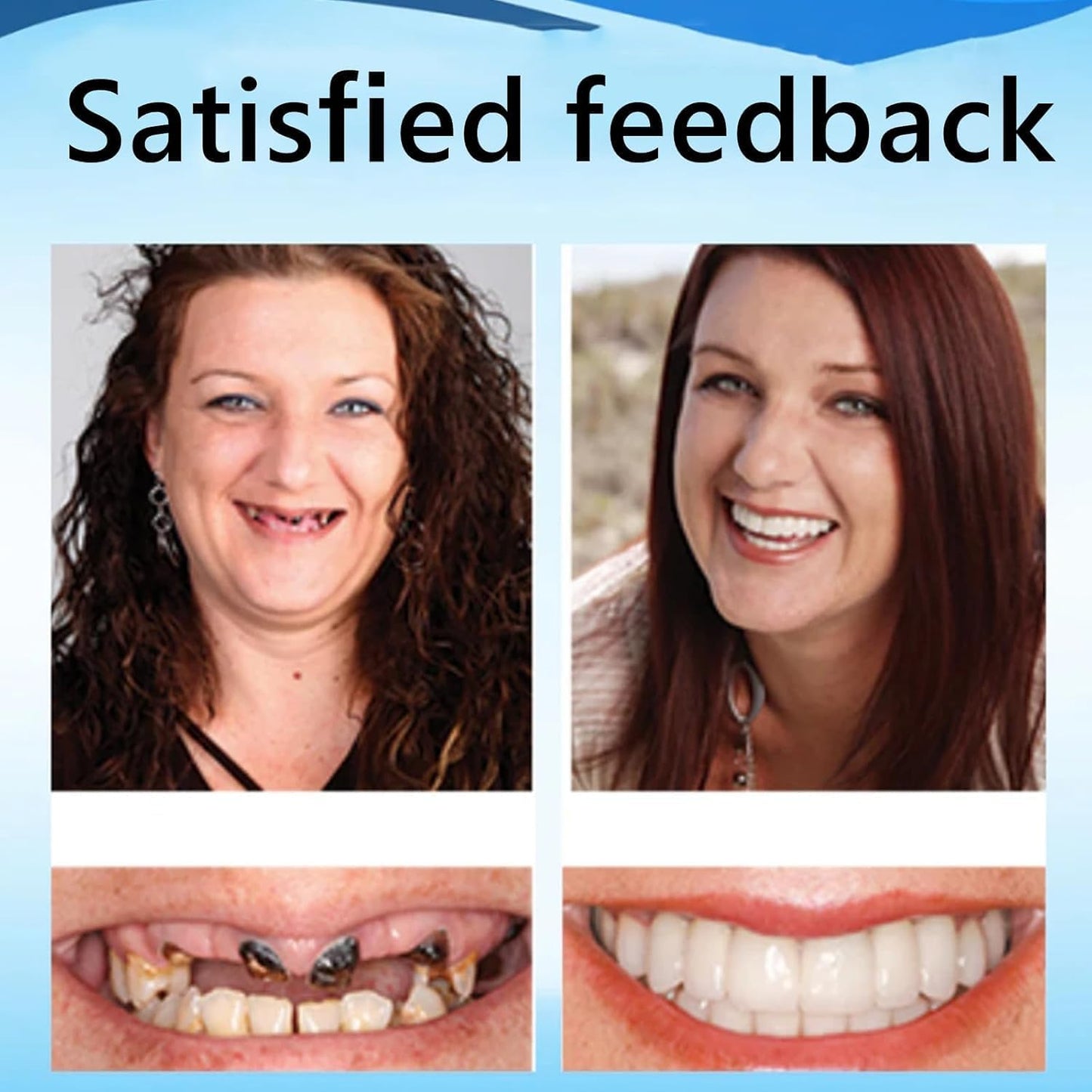 Denture Reline Kit | Silicone Denture Reline | Denture Repair Kit| RenewSmile