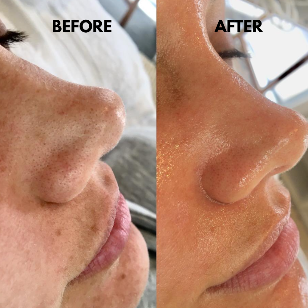 SkinSonic™ – Ultrasonic Skin Scrubber for Deep Cleansing, Gentle Care & Radiant Skin [50% Off]