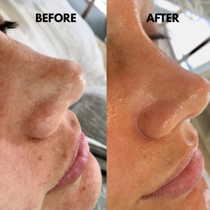 SkinSonic™ – Ultrasonic Skin Scrubber for Deep Cleansing, Gentle Care & Radiant Skin [50% Off]