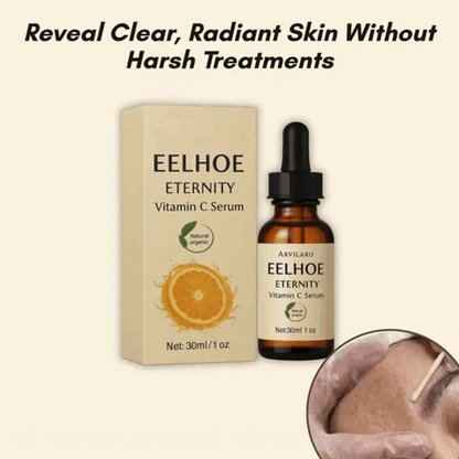 Eelhoe™ – Eternity Vitamin C Serum for Face, Hands & Body for Radiant Skin [1 + 1 Free]