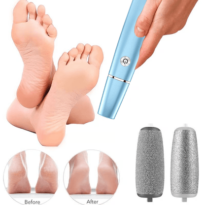Electric Callus Remover | Powerful Pedicure Tool | Smooth Feet at Home | SilkStride