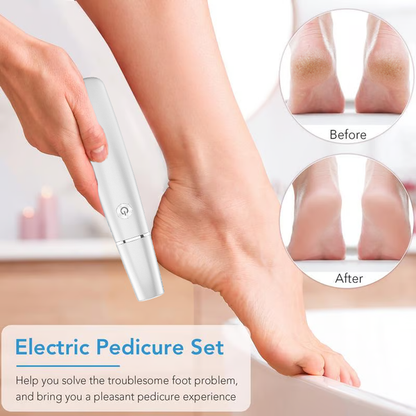 Electric Callus Remover | Powerful Pedicure Tool | Smooth Feet at Home | SilkStride