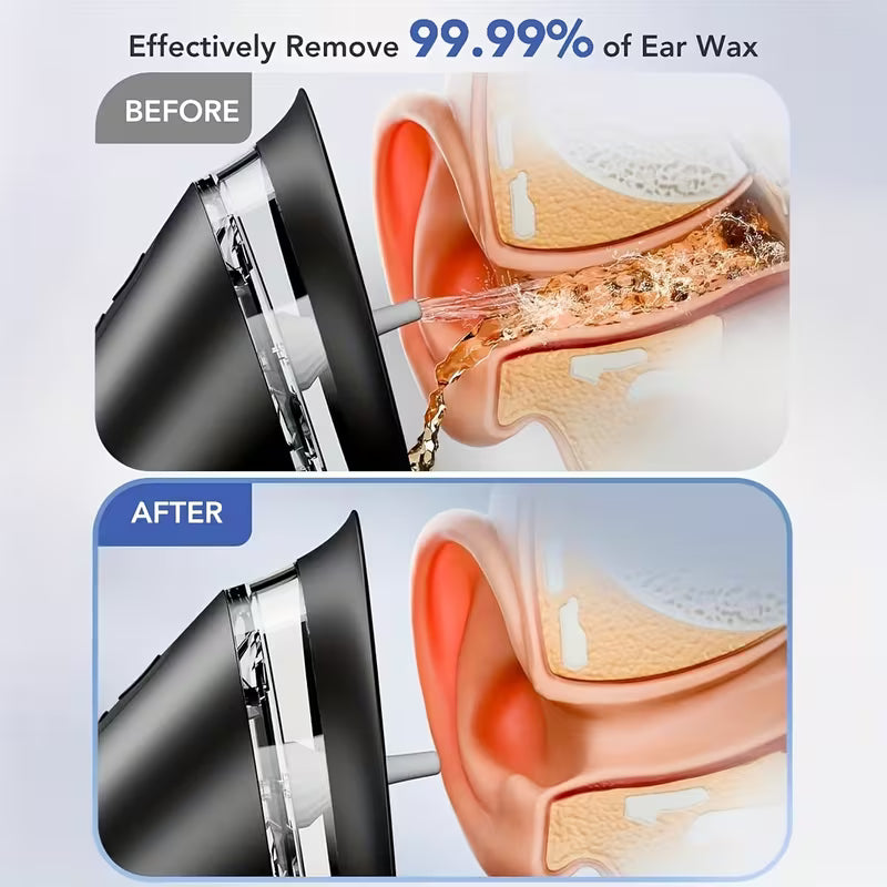 Ear Wax Removal | Safe Ear Cleaning | Electric Water Irrigation System | AuriPure