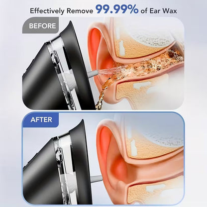 Ear Wax Removal | Safe Ear Cleaning | Electric Water Irrigation System | AuriPure