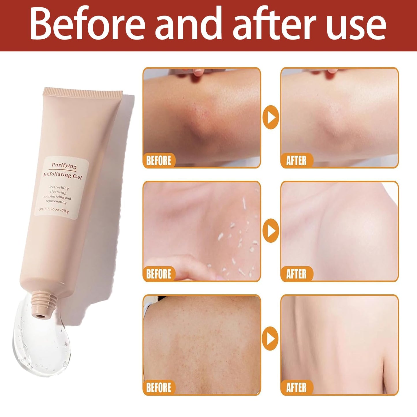 Exfoliating Gel | Gentle Peeling Formula | Deep Hydration | FreshSkin