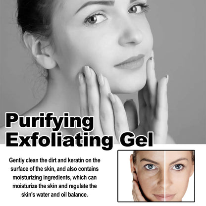 Exfoliating Gel | Gentle Peeling Formula | Deep Hydration | FreshSkin
