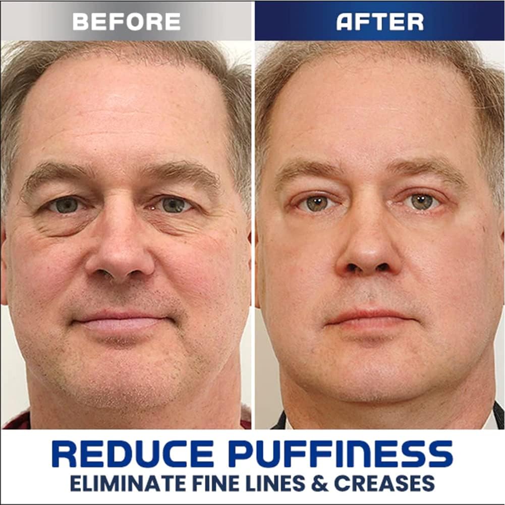LumiLift™ – Peptide Formula to Reduce Puffiness & Provide Firming Effect Everyday Care [1 + 1 Free]