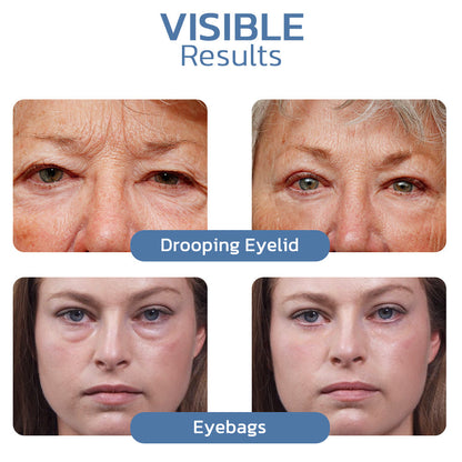 LumiLift™ – Peptide Formula to Reduce Puffiness & Provide Firming Effect Everyday Care [1 + 1 Free]