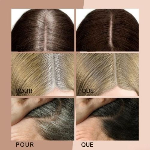 HairHalo™ – Say Goodbye to Roots Instantly for Perfect, Flawless Hair Everyday Style [1 + 1 Free]