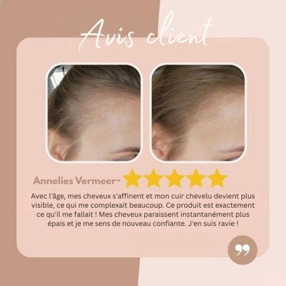 HairHalo™ – Say Goodbye to Roots Instantly for Perfect, Flawless Hair Everyday Style [1 + 1 Free]