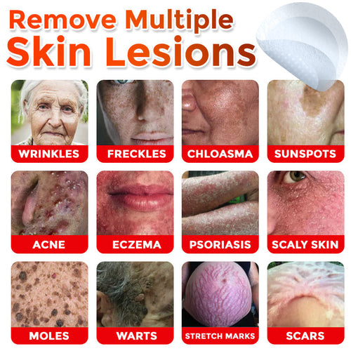 Micro Patch Skin Tag Removal Kit – Gentle At-Home Treatment (9 Patches)