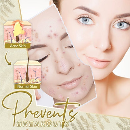 ActiSkin™ – 24K Gold Serum for Line Refreshing for Smooth, Radiant & Well-Cared-for Skin [1 + 1 Free]