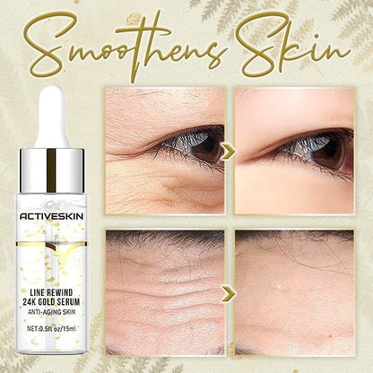 ActiSkin™ – 24K Gold Serum for Line Refreshing for Smooth, Radiant & Well-Cared-for Skin [1 + 1 Free]