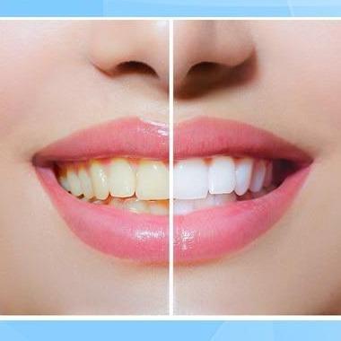WhitePen™ – Teeth Whitening Pen for Bright White, Well-Groomed & Healthy Teeth Everyday Care [1 + 1 Free]