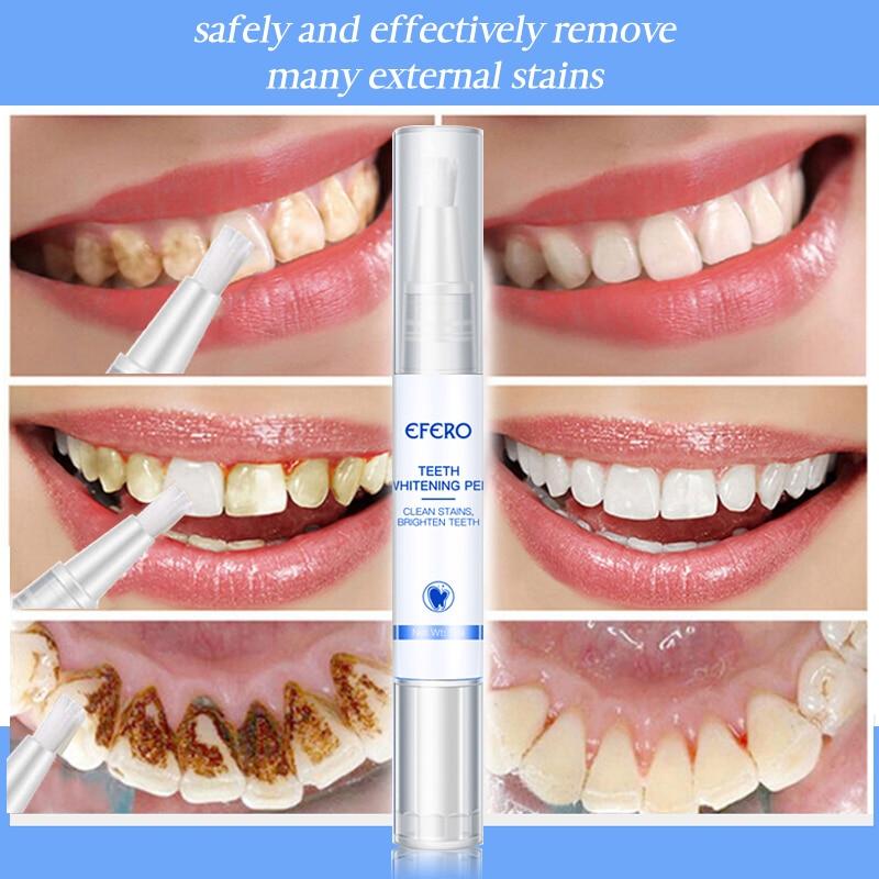 WhitePen™ – Teeth Whitening Pen for Bright White, Well-Groomed & Healthy Teeth Everyday Care [1 + 1 Free]