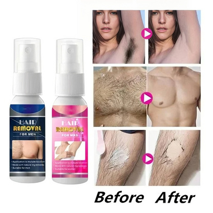 Hair Removal Spray | Pain-Free Formula | Sensitive Skin Care | FreshBare Mist