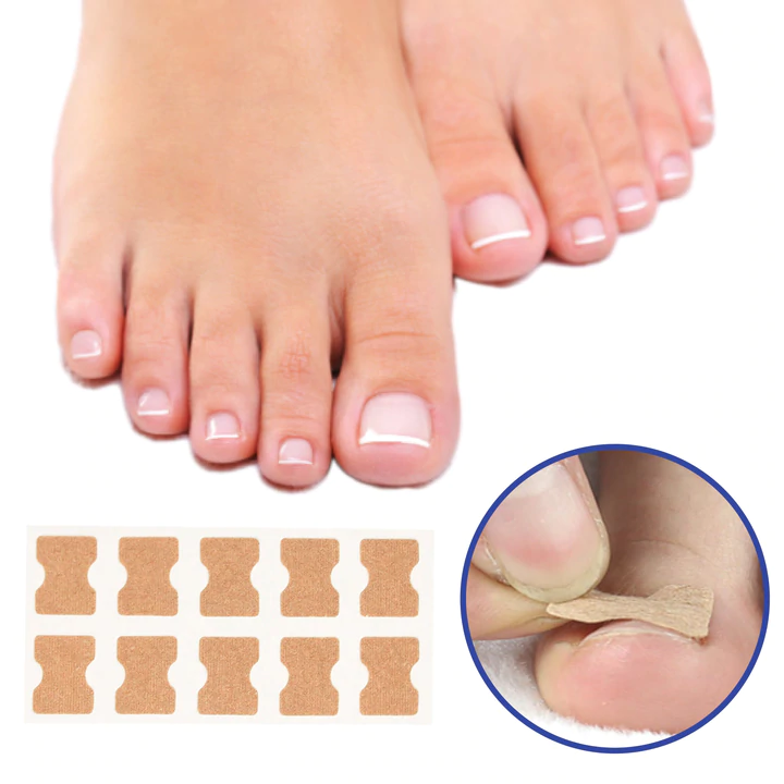 Nail Correction Strips for Ingrown & Uneven Nails – 50 Pieces