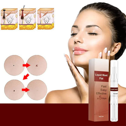 WipeOff™ - Remove Stubborn Stains and Warts [1 + 1 Free]