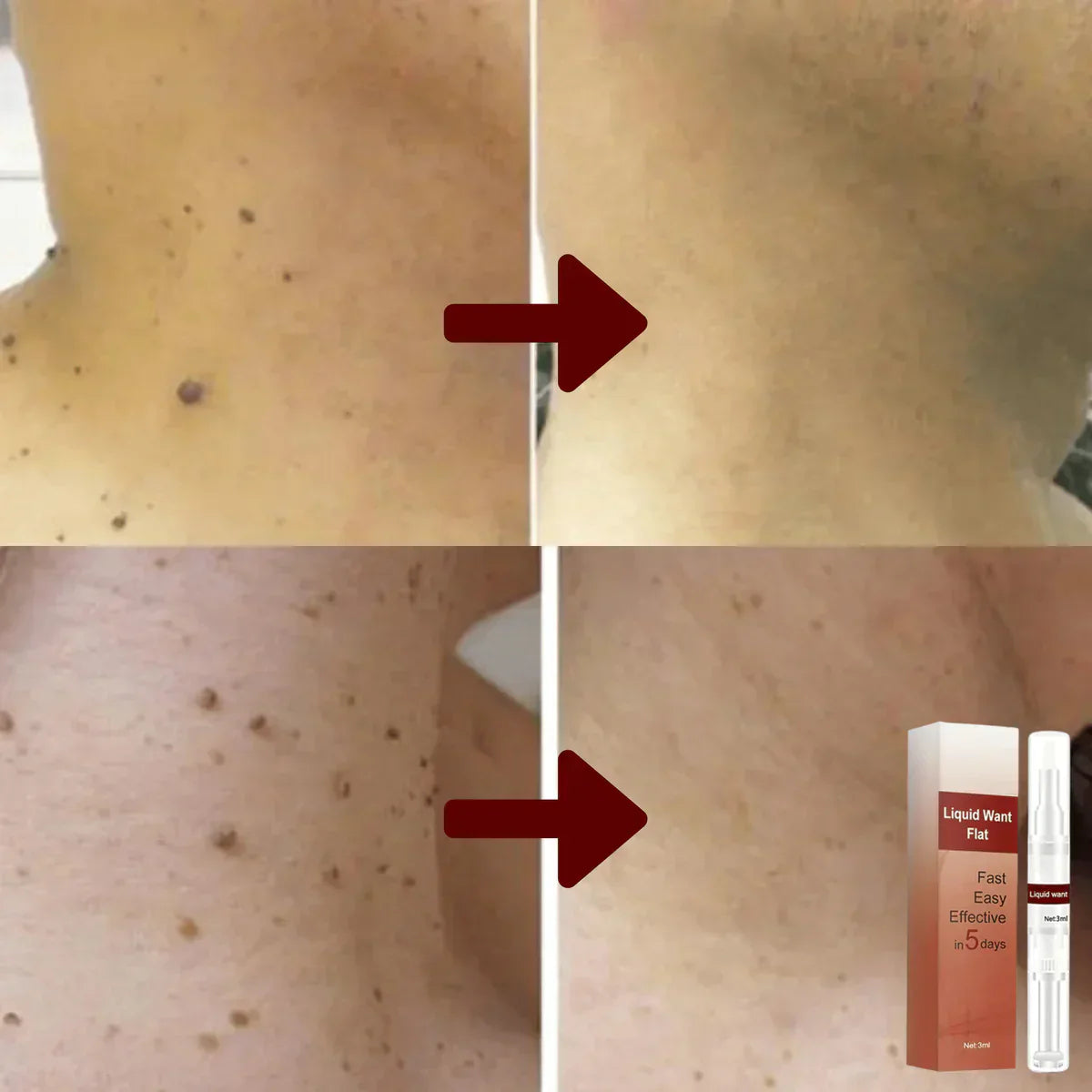 WipeOff™ - Remove Stubborn Stains and Warts [1 + 1 Free]