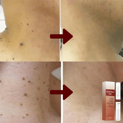 WipeOff™ - Remove Stubborn Stains and Warts [1 + 1 Free]