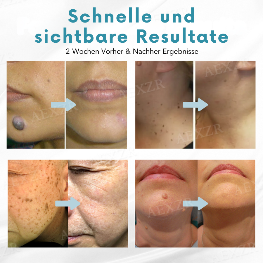 Radiant™ – Fast Skin Rejuvenation (Last Day of Discount) [1 + 1 Free]