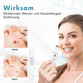 CO2 Laser Skin Tag & Mole Removal Pen for Home Use