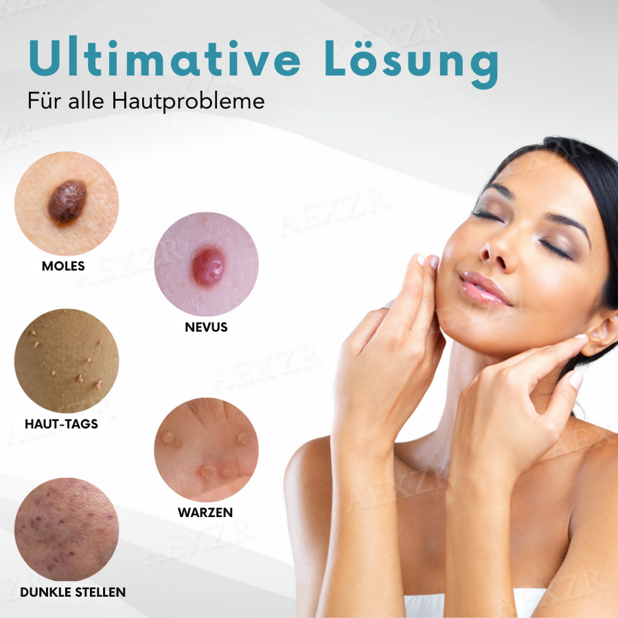 CO2 Laser Skin Tag & Mole Removal Pen for Home Use