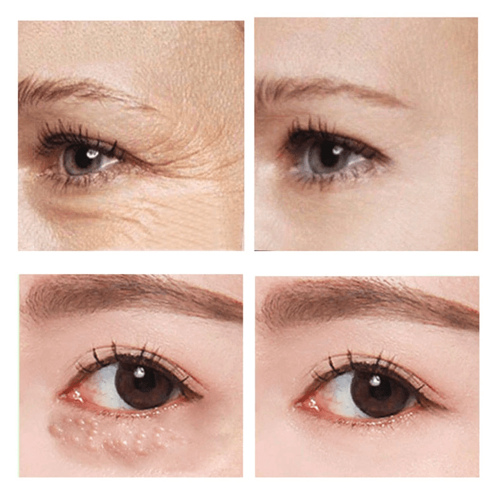 SleekEyes™ – Fast-Acting Firming Eye Cream for Smooth, Well-Groomed Eye Area Everyday Care [1 + 1 Free]