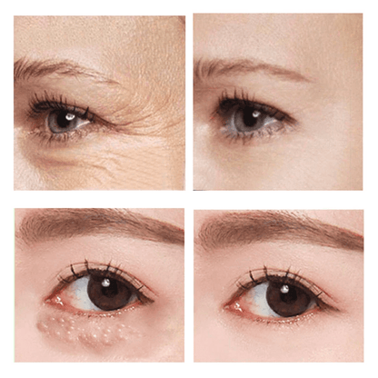SleekEyes™ – Fast-Acting Firming Eye Cream for Smooth, Well-Groomed Eye Area Everyday Care [1 + 1 Free]