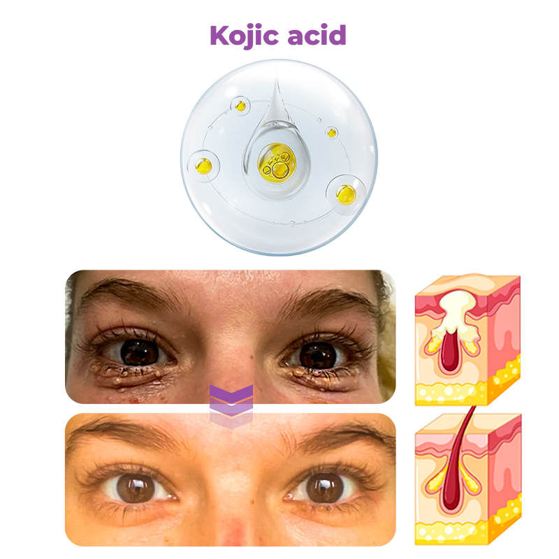 Electric Serum Pen for Skin Tightening with High-Frequency Technology