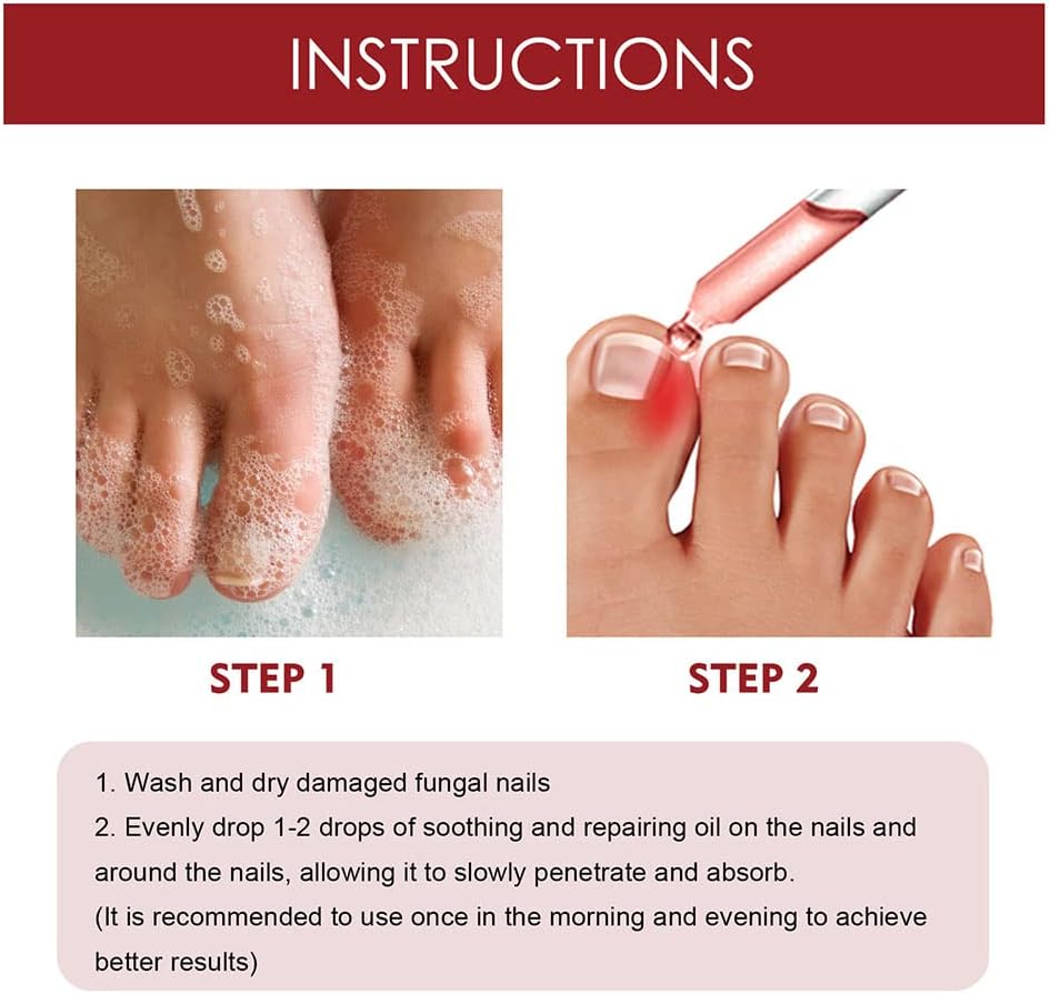 Nail Care Serum | Brittle Nail Repair | Visible Results in 4 Weeks | Easy Daily Use | HealNail