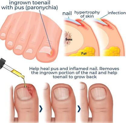 Nail Care Serum | Brittle Nail Repair | Visible Results in 4 Weeks | Easy Daily Use | HealNail