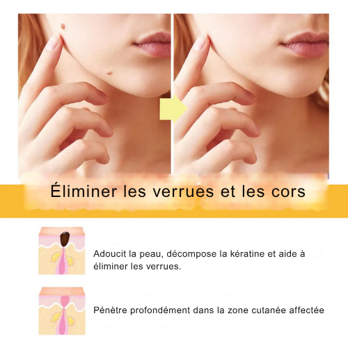 Bee Venom & Aloe Vera Skin Tag Removal Serum for Blemishes