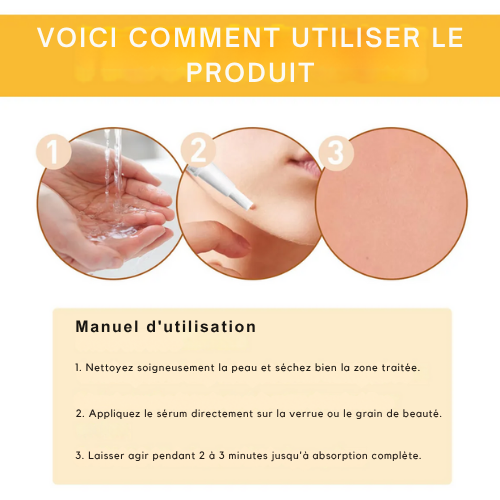 Bee Venom & Aloe Vera Skin Tag Removal Serum for Blemishes