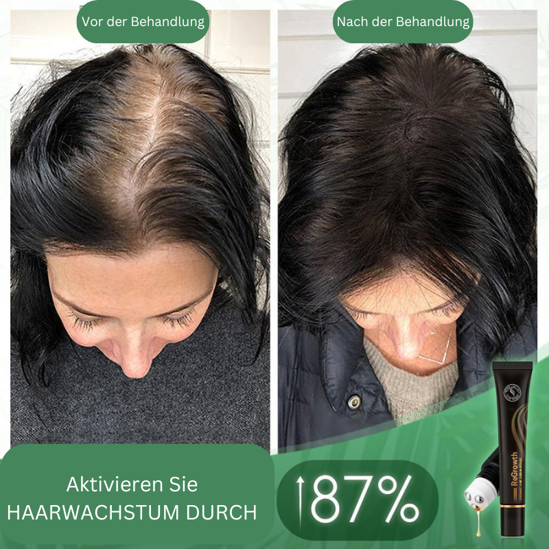 Organic Hair Growth Serum Roller for Visibly Fuller & Thicker Hair