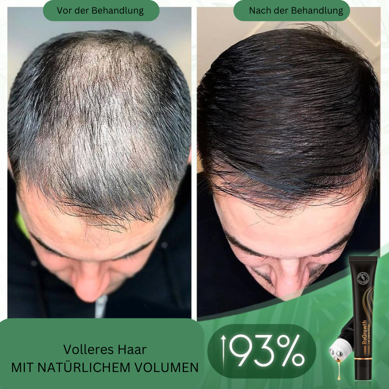 Organic Hair Growth Serum Roller for Visibly Fuller & Thicker Hair