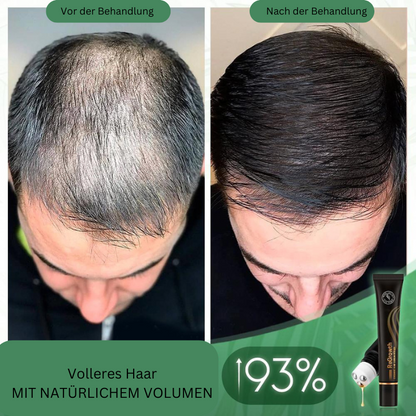 Regrowth – Natural Organic Hair Serum Roller for Visibly Fuller Hair [Buy 1 + 1 Free]