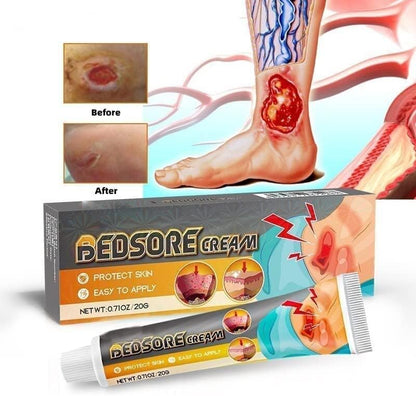Pressure Ulcer Cream | Skin Repair Support | Soothing Relief