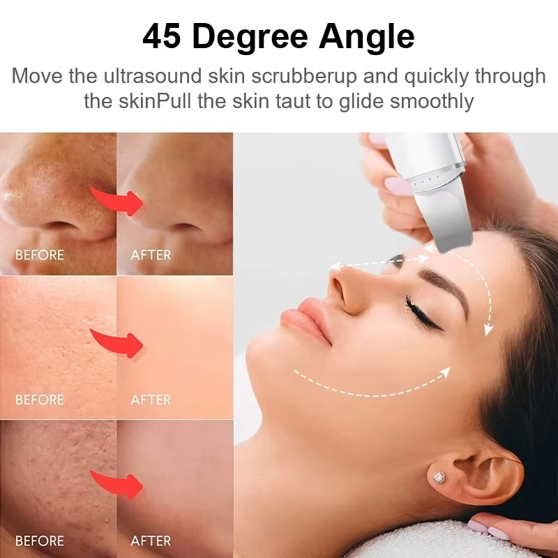 SkinSonic™ – Ultrasonic Skin Scrubber for Deep Cleansing, Gentle Care & Radiant Skin [50% Off]
