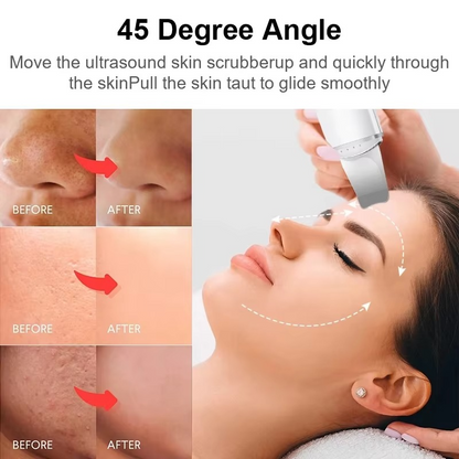 SkinSonic™ – Ultrasonic Skin Scrubber for Deep Cleansing, Gentle Care & Radiant Skin [50% Off]