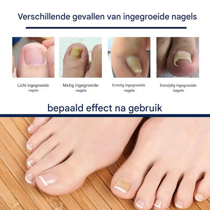 HealthyNail™ – Beautify Your Natural Nails in a Gentle, Sustainable Way [25 + 25 Free]