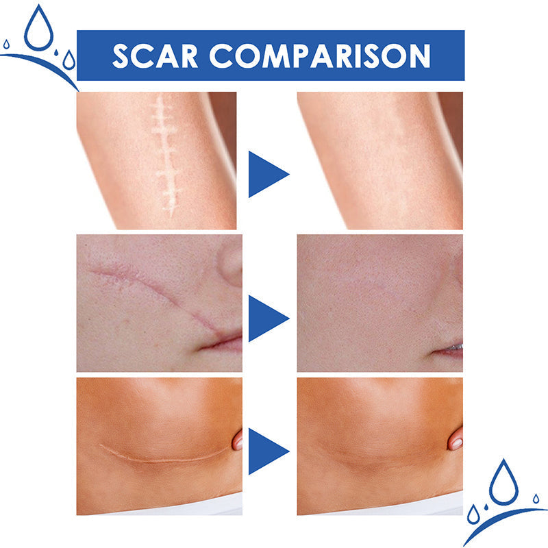 Bio-Peptide Skin Serum for Scar Reduction & Firmer Smoother Skin