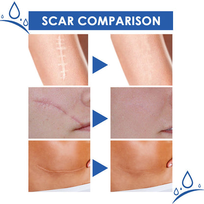 DermalSync™ – For Scar Reduction, Firming, Care, Regeneration & Smoother Skin Everyday Use [50% Off]