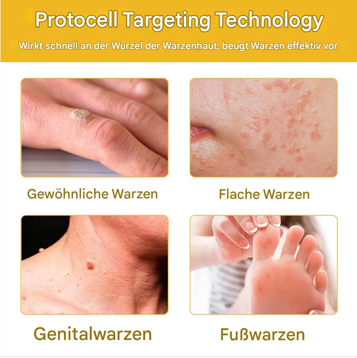 TagAway™ – Effective Removal of Warts & Skin Growths for Smooth, Clear Skin [1 + 1 Free]