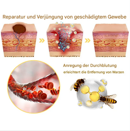 TagAway™ – Effective Removal of Warts & Skin Growths for Smooth, Clear Skin [1 + 1 Free]