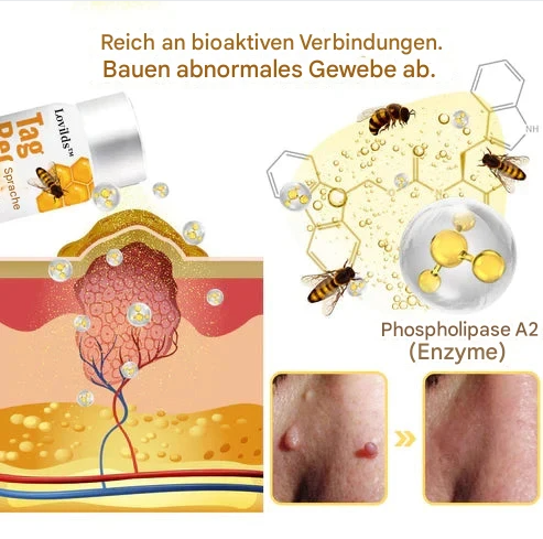 TagAway™ – Effective Removal of Warts & Skin Growths for Smooth, Clear Skin [1 + 1 Free]