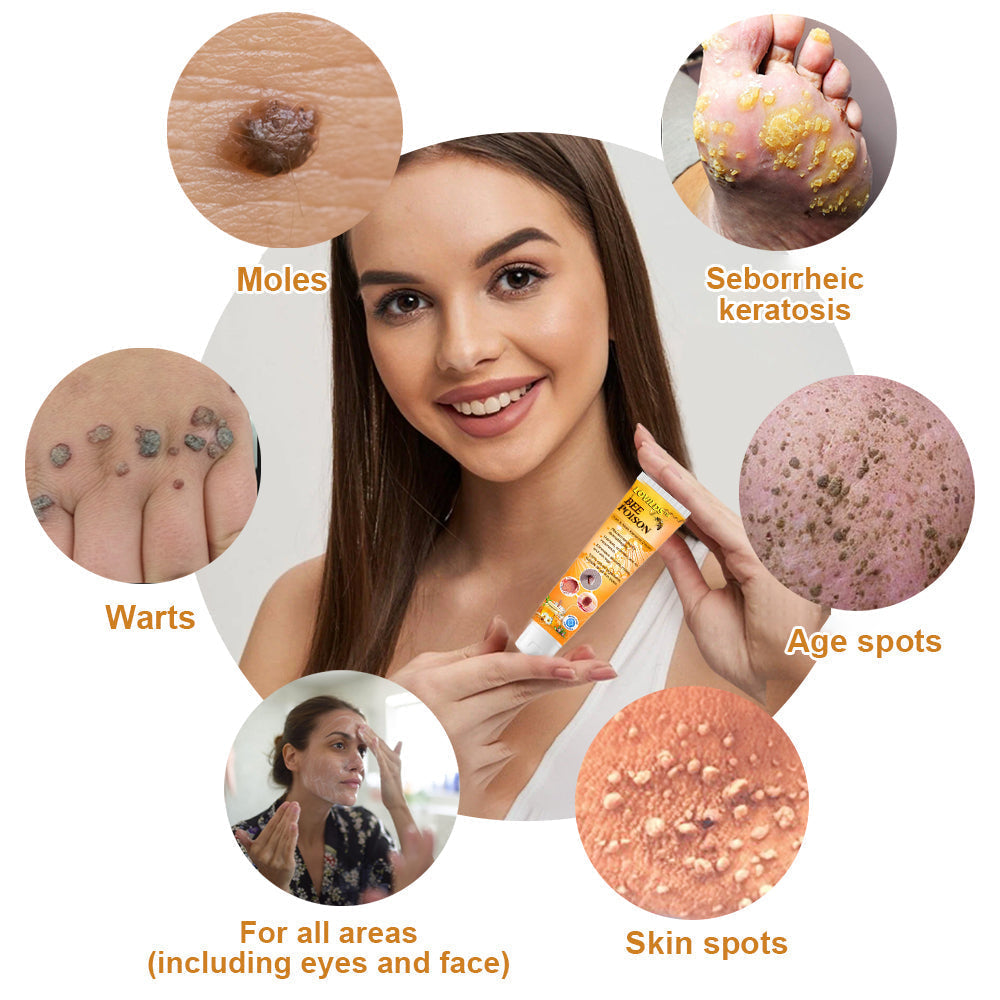 Bee Venom Skin Tag Removal Cream for Face and Body
