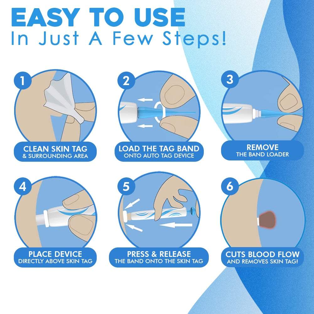 FlawFix™ – Wart Removal Set for Gentle, Effective & Safe Removal [50% Off]
