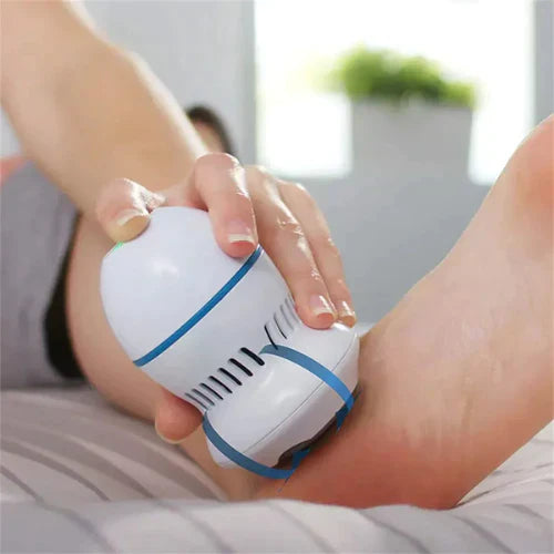 Electric Foot File for Callus Removal – Rechargeable & Wireless